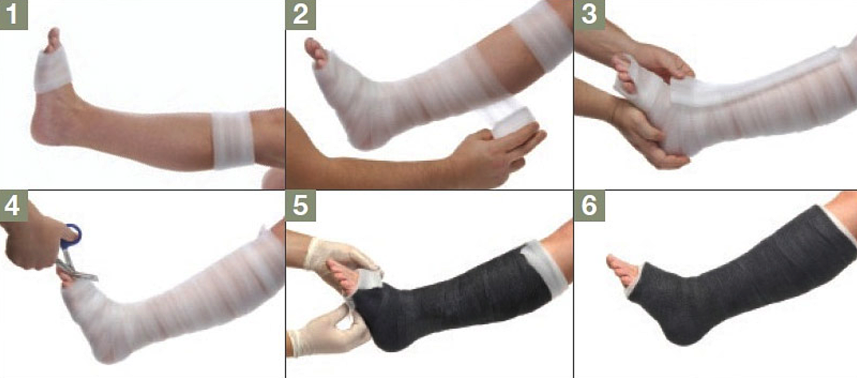 Waterproof Cast & Splints - Back on Track